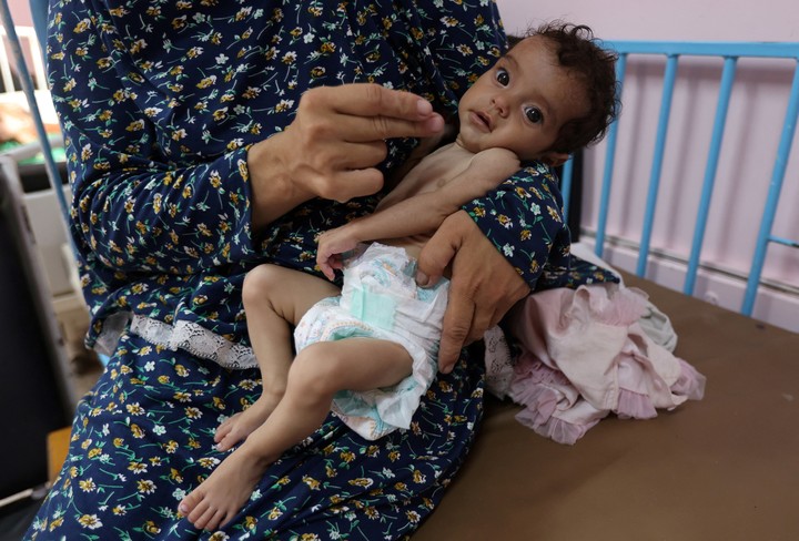 Una mujer palestina sostiene a su hija de cinco meses, Rama Abu Aya, quien está desnutrida, según los médicos, en el Hospital Nasser en Khan Younis, en el sur de la Franja de Gaza. Foto Reuters